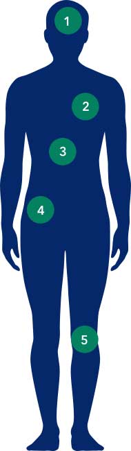 Image of body with circles numbered one to five.
